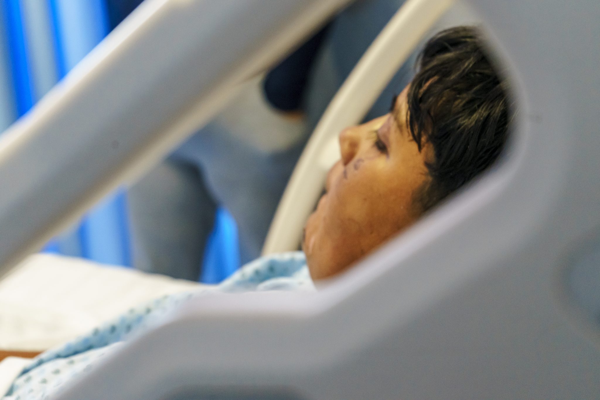 SSG LLAMA A PREVENIR QUEMADURAS POR ACCIDENTES DURANTE TEMPORADA DECEMBRINA