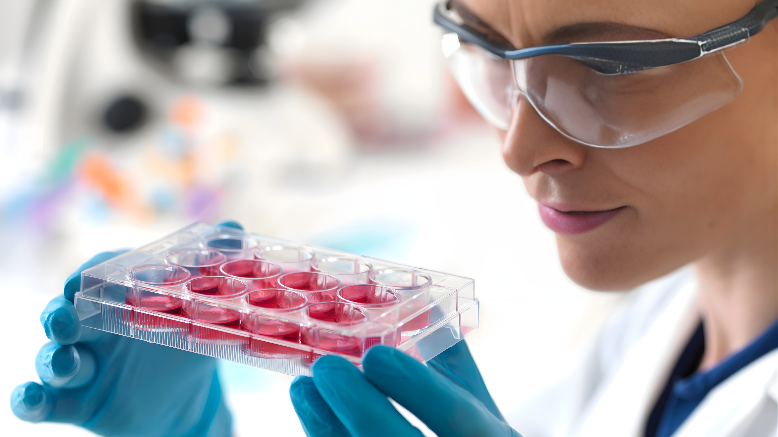 UN TRASPLANTE DE CÉLULAS MADRE LOGRA REMISIÓN DEL VIH: UN AVANCE ESPERANZADOR